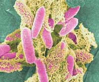 microscope picture of e coli